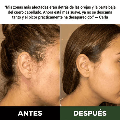 Exfoliante Capilar Natural Nuvani
